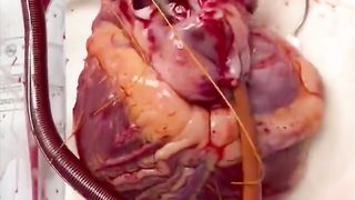 Heart 9