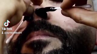 The best way to remove hair from the nose without pain