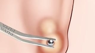 asmr_귀_염증치료하기(360p).