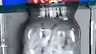 Urgence_#FruitSurgery!_Worlds_Largest_Gummy_Bear_has_36_babies!_????????_#DiscountDentist_#FoodSurgery(360p).