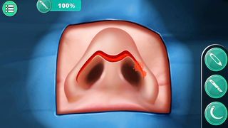 Nose surgery 2