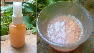 Potato Juice toner for dark spots,pimples,hyper pigmentation, crystal clear skin, skin care