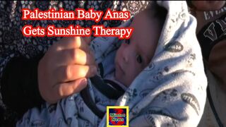 Palestinian baby Anas gets sunshine therapy at camp in Rafah, Gaza