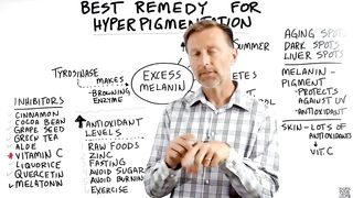 How to Get Rid of Hyperpigmentation (Aging or Dark Spots)