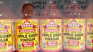 When NOT to Take Apple Cider Vinegar (ACV)