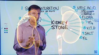 Kidney Stones 101: Causes, Symptoms & Remedies – Dr.Berg