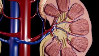 Clean Out Your Kidneys of Oxalates and Stones - Dr. Berg