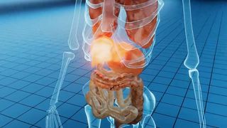 The 6 Best Ways to Heal a Fatty Liver
