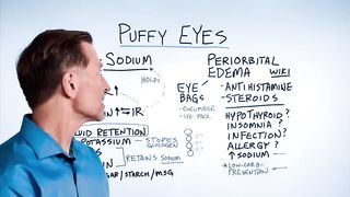 THIS is How You Get Rid of Puffy Eyes FOR GOOD!