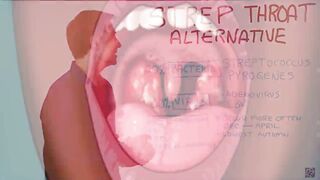 Strep Throat – The Fastest Way to Relieve Pain – Remedies for Strep Throat – Dr.Berg