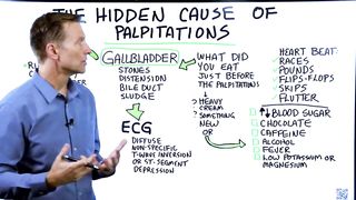 The Hidden Causes of Heart Palpitation – Revealed by Dr.Berg