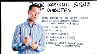 7 Skin Warning Signs of Diabetes