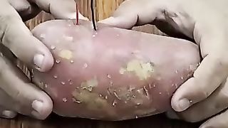 A potato bijli