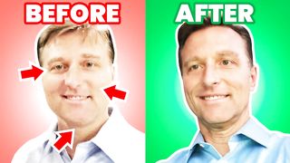 7 Things Your Face Tells You About Your Blood Sugars