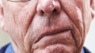 What To Do After a Stroke: IMPORTANT
