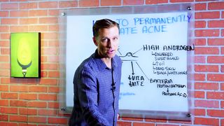 How To Get Rid Of Acne? Eliminate Acne Permanently! – Dr.Berg
