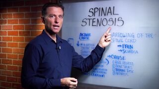 What is Spinal Stenosis And It's Causes Explained By Dr. Berg