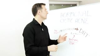 Best Remedy for Hormonal Cystic Acne – Dr.Berg