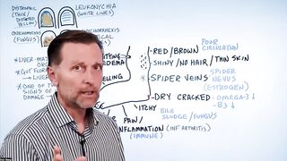 How to Use Your Feet to Diagnose Liver Problems—Dr. Berg Explains