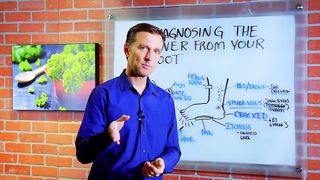 How Your Feet Are Warning You About Your Liver Problems - Dr. Berg Explains