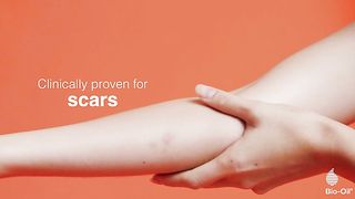 Bio-Oil Skincare Body Oil, Vitamin E, Serum for Scars & Stretch Marks, Face & Body Moisturizer, 2 oz, All Skin Types