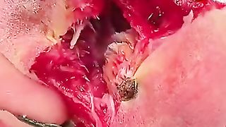 Video views 22