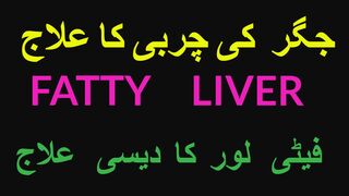 جگر کی چربی کا علاج