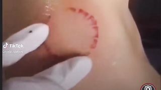 Love bites 2