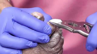 CUTTING OF SUPER THICK, LONG & CRUSTY TOENAILS - 003