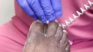 CUTTING OF SUPER THICK, LONG & CRUSTY TOENAILS - 010