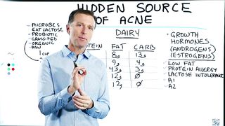 What Causes Acne? – The Surprising Hidden Source of Acne – Dr.Berg
