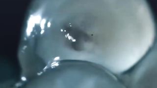 Ever Seen Slugs Hatch？ ｜ BBC Earth