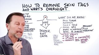 How to Remove Skin Tags and Warts Overnight - Dr. Berg Explains