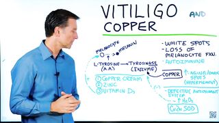 Fix Vitiligo With Copper