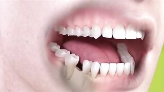 Dental Care