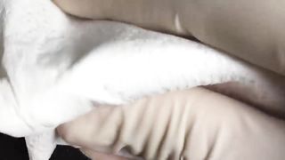 BEST Pimple Popping __ Big Cystic Acne Blackheads __ Whiteheads Removal _ Squeezing Pimples _ H#065 - 004