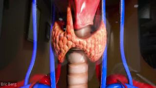 If You Have Hypothyroidism, Avoid These Foods