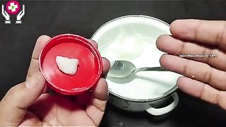Try the best remedy for moles on the body