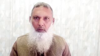 چہرہ پر سیاہ  داغ کا علاج --   BLACK SPOTS ON  FACE