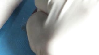 BEST Pimple Popping __ Big Cystic Acne Blackheads __ Whiteheads Removal _ Squeezing Pimples _ H#075 - 002