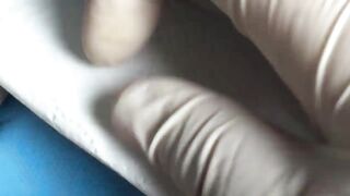 BEST Pimple Popping __ Big Cystic Acne Blackheads __ Whiteheads Removal _ Squeezing Pimples _ H#075 - 007