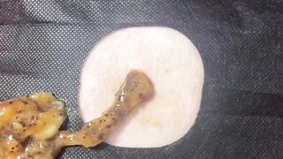 BEST Pimple Popping __ Big Cystic Acne Blackheads __ Whiteheads Removal _ Squeezing Pimples _ H#086 - 005