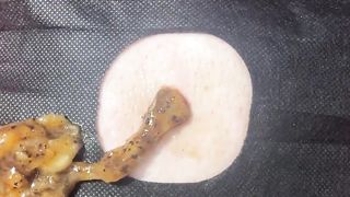 BEST Pimple Popping __ Big Cystic Acne Blackheads __ Whiteheads Removal _ Squeezing Pimples _ H#086 - 006