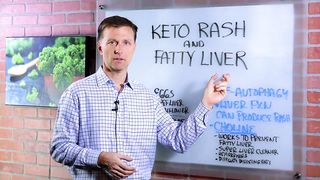 Choline: One of The Best Vitamins for Fatty Liver – Dr. Berg