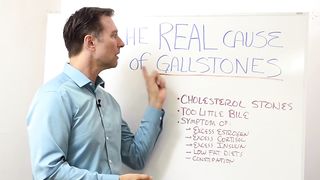 What Causes Gallstones & How to Treat Them – Dr.Berg