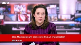 Elon Musk announces first Neuralink wireless brain chip implant in a human