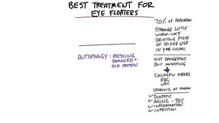 Best Treatment for Eye Floaters