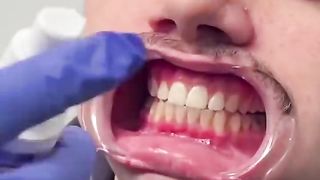 Teeth whitening toothpaste