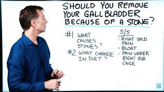 Should I Remove My Gallbladder If I have Stones? – Dr.Berg