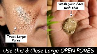 How to make Aloevera and Multani Mitti Face wash,Close Large open pores,How to improve uneven skin